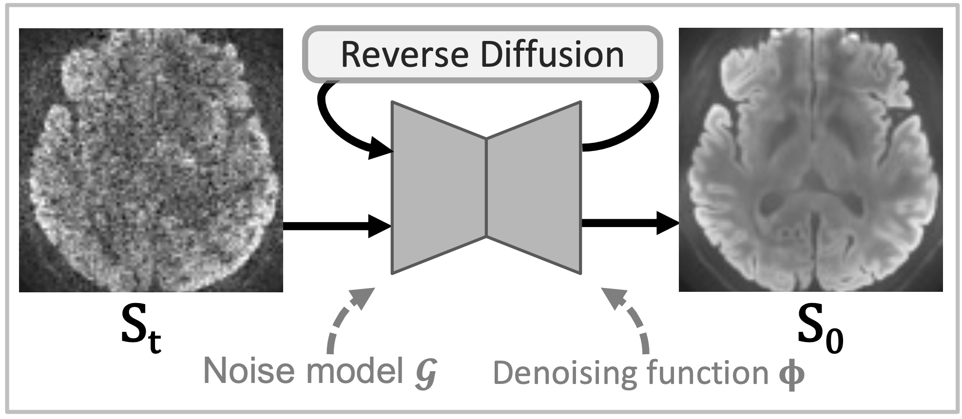 DDM2 MRI denoising with diffusion models