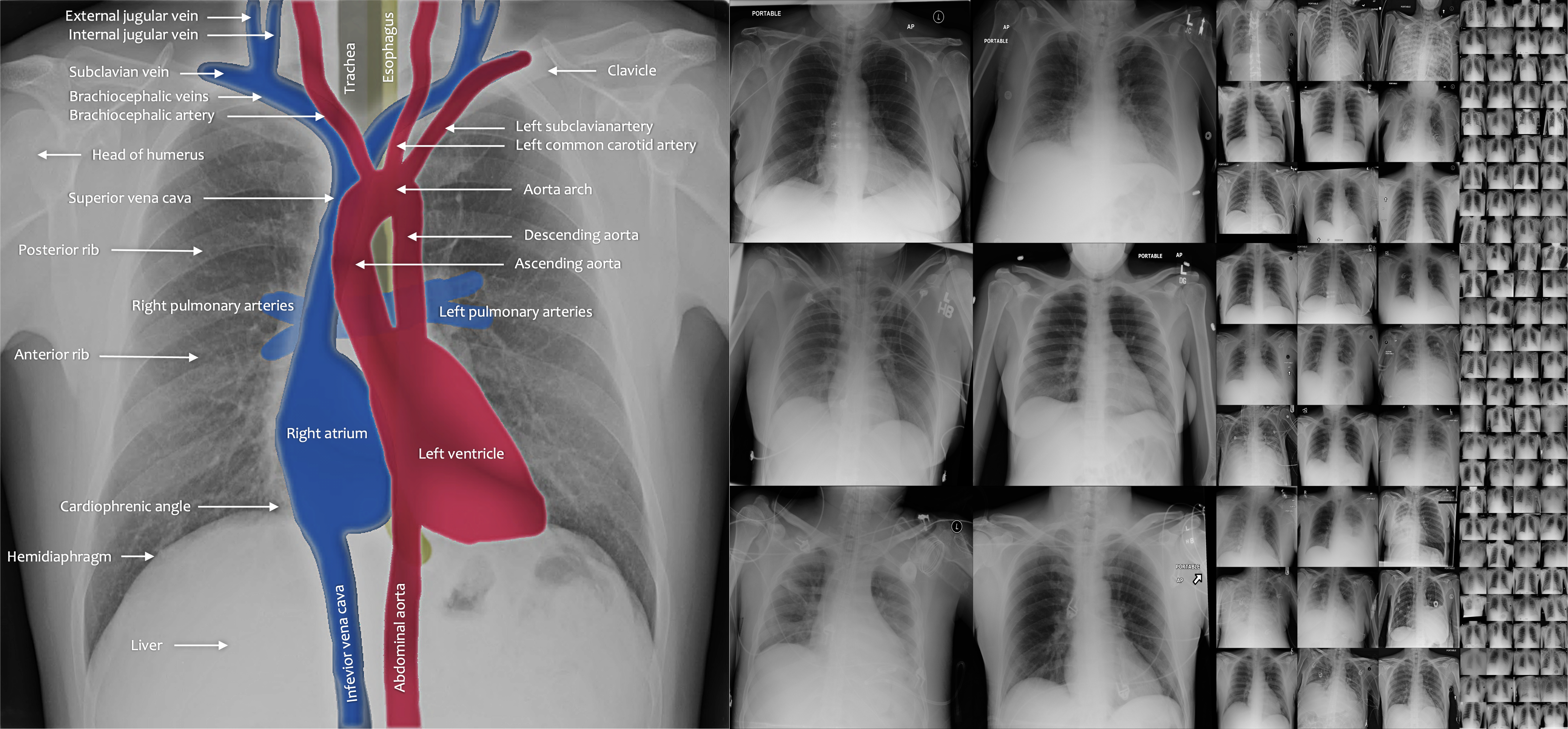 SimSID chest anatomy anomaly detection