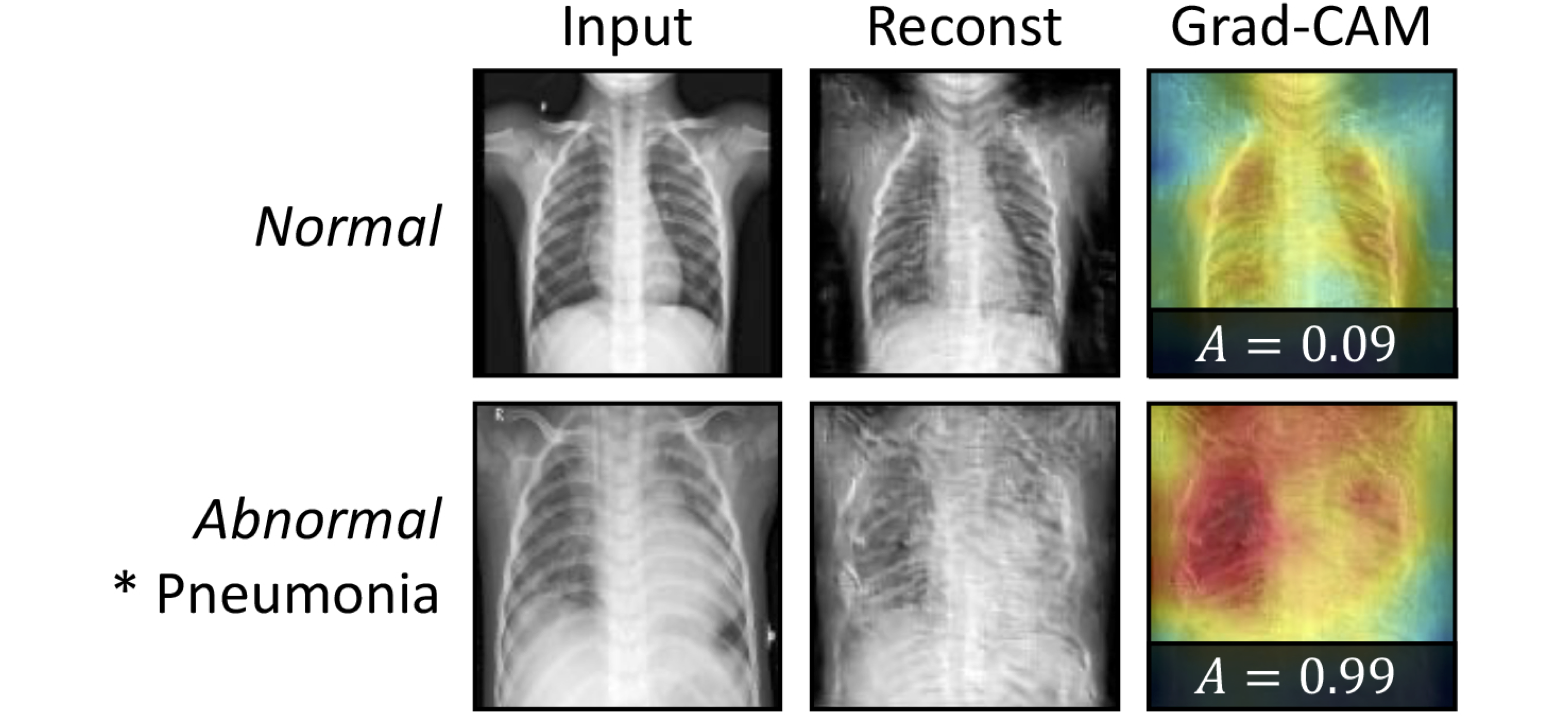 SQUID deep feature in-painting for anomaly detection